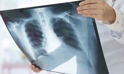 Zatüre vakaları artıyor!