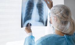 ‘Akciğer kanseri büyük ölçüde önlenebilir bir hastalık’