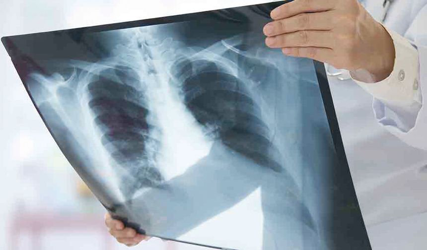 Zatüre vakaları artıyor!